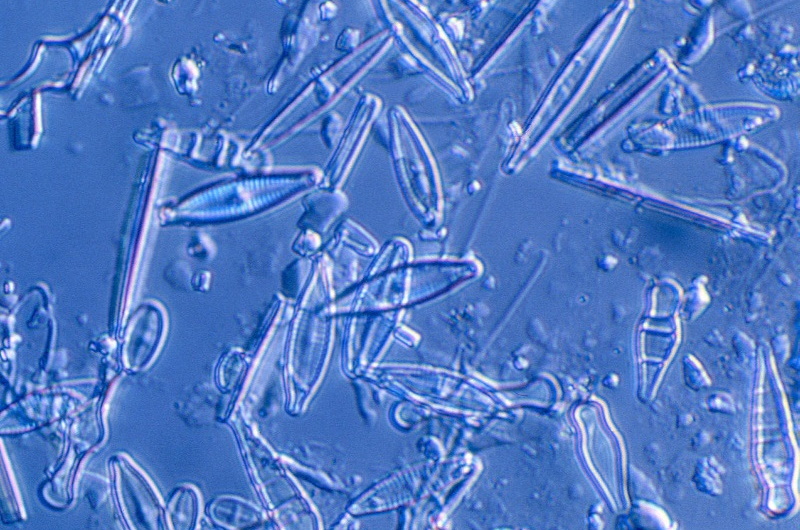 diatoms